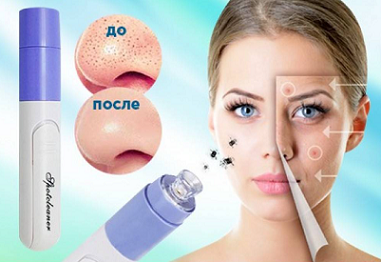 Лучшие вакуумные очистители пор